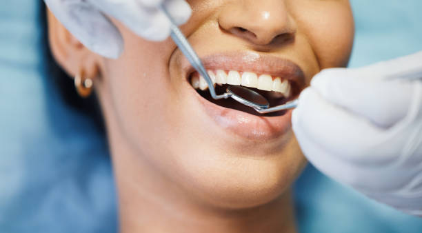 Best Emergency Wisdom Tooth Extraction in Prestbury, IL